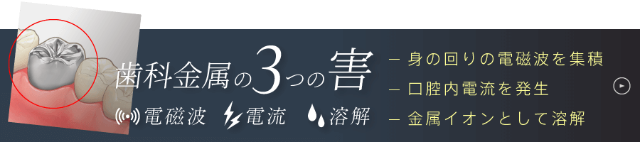 歯科金属の3つの害