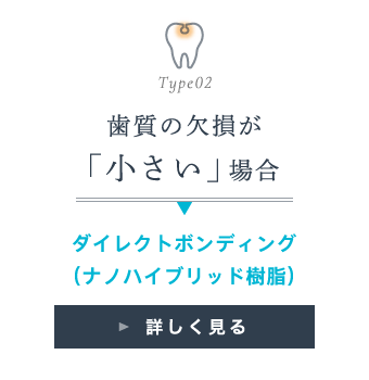 歯質の欠損が「小さい」場合：ダイレクトボンディング（ナノハイブリッド樹脂）